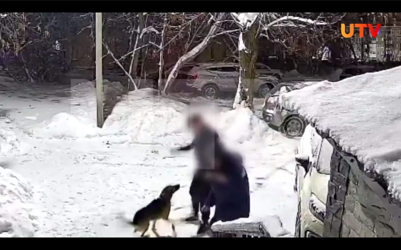 Домашняя собака набросилась на подростка и чуть не растерзала его в Уфе