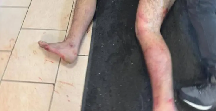 «Охрана нужна!» В Самарской области дебошир откусил нос кассиру