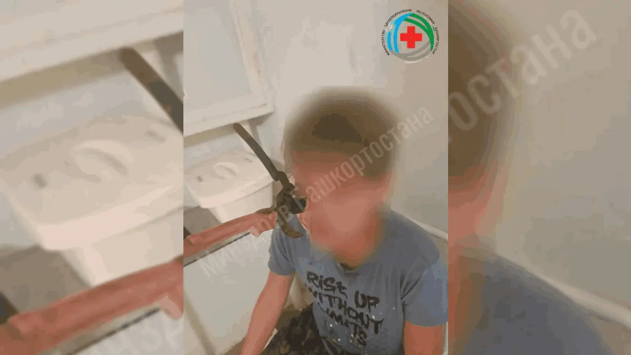 В Башкирии врачи спасли зрение подростку, которому в лицо попал садовый секатор
