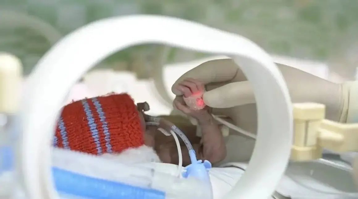 В Башкирии родилась малышка весом меньше пакета молока — врачи спасли ребёнка