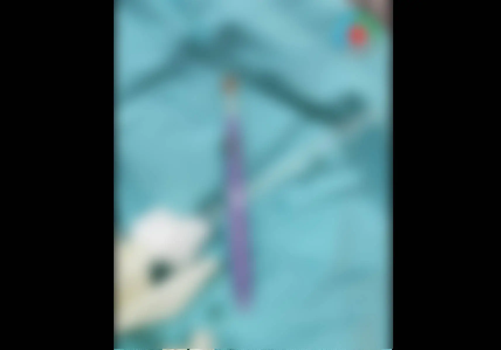 Неожиданный предмет обнаружили в животе мужчины из Уфы – он признался, как это туда попало