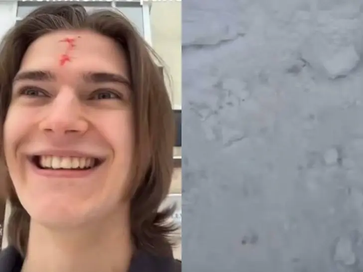 «Лоб в крови, на лице улыбка»: модель из Уфы передал привет ЖЭУ