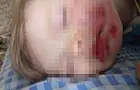 Прокуратура Уфы начала проверку детского сада, в котором покусали маленького ребенка 