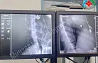 В Башкирии врачи извлекли пулю из сердца девочки