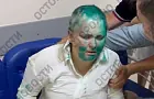 Пережившую нападение в Чечне журналистку Елену Милашину доставили в Беслан